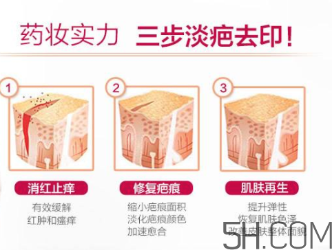 ISDIN怡思丁祛疤膏怎么用？ISDIN怡思丁祛疤膏使用說明