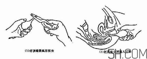 開(kāi)塞露怎么用？開(kāi)塞露用后多久會(huì)排便？