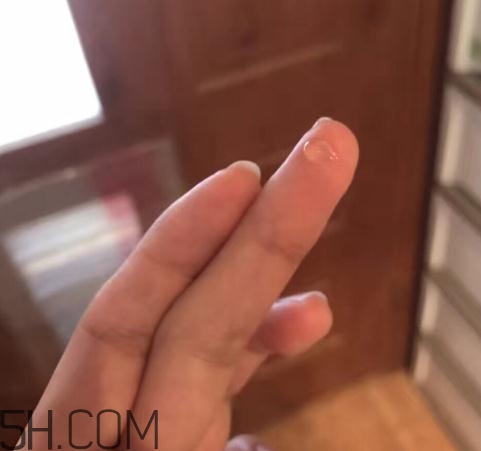 倍舒痕可以去痘印嗎？倍舒痕能涂在痘痘上嗎？