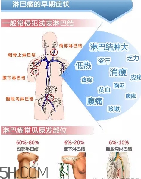淋巴癌是怎么回事？淋巴癌如何診斷