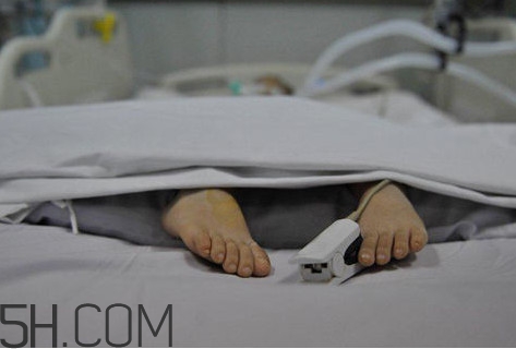 腦死亡是什么意思？腦死亡判定有嚴(yán)格標(biāo)準(zhǔn)