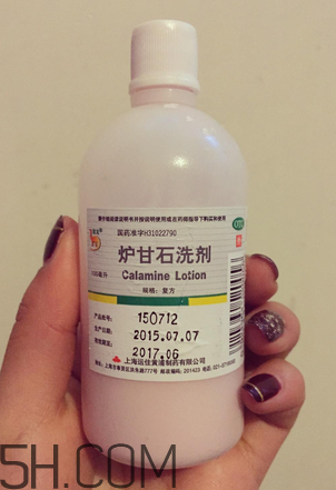 爐甘石洗劑多少錢一瓶？爐甘石洗劑治痤瘡嗎？