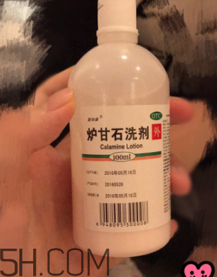 爐甘石洗劑是洗還是擦？爐甘石洗劑是什么顏色？