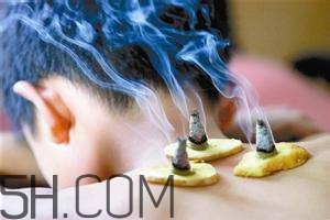 艾灸對慢性咽炎有用嗎？慢性咽炎可以通過艾灸來治療嗎？