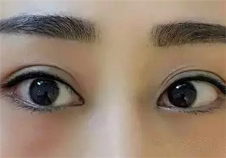 怎么紋美瞳線好看？紋美瞳線的危害