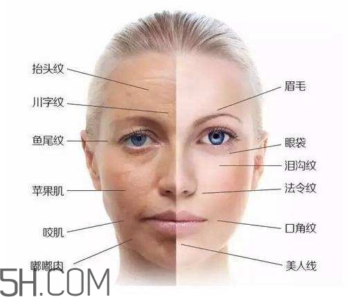 怎么預(yù)防皺紋的產(chǎn)生？導(dǎo)致皺紋的產(chǎn)生的原因有哪些？