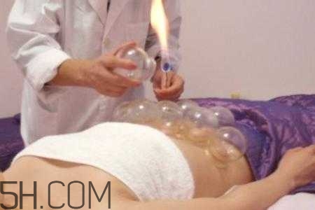腹部拔罐可以減肥嗎？腹部拔罐拔哪個(gè)位置？