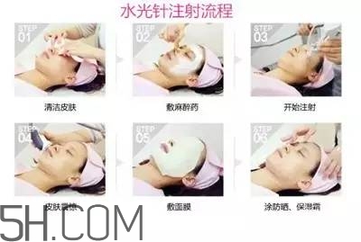 打水光針多久打一次？水光針的誤區(qū)