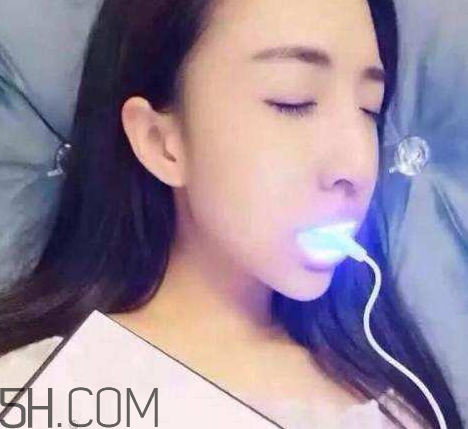 美牙儀可以兩個人用嗎？美牙儀用多久才有作用？