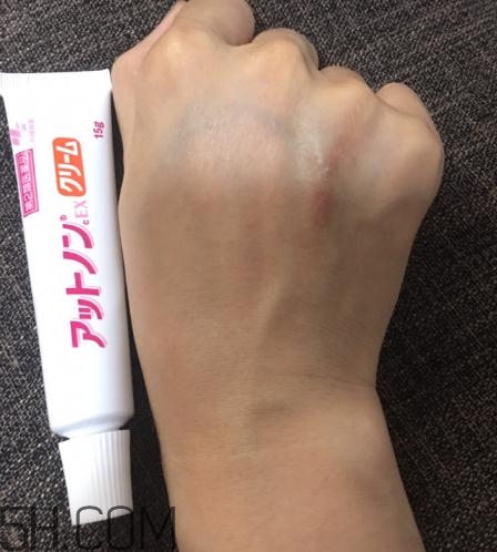 小林制藥祛疤膏有效嗎？小林制藥祛疤膏怎么樣？