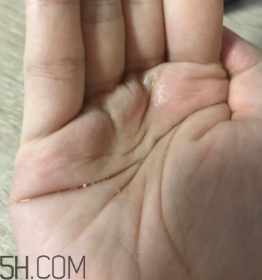 雪肌精卸妝油糊眼睛嗎？雪肌精卸妝油悶痘嗎？
