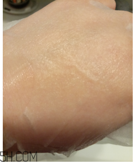 WIS痘肌修護(hù)面膜有效嗎？適合敏感肌嗎？