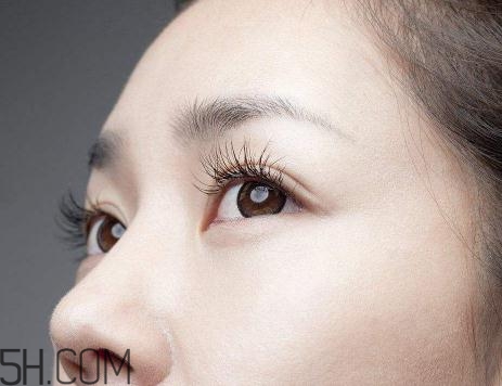 上瞼提肌手術(shù)有必要嗎？上瞼提肌后是永久的嗎？
