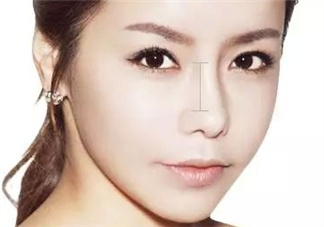 達(dá)拉斯隆鼻是什么材料？達(dá)拉斯隆鼻怎么樣？