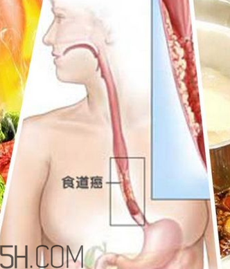 吃太燙會得癌？燙食不僅對胃不好還容易得癌
