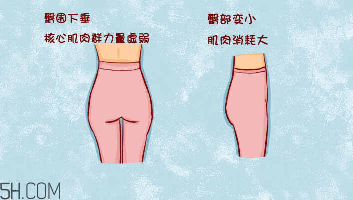 臀部護理對健康有什么影響？日常如何保養(yǎng)臀部健康？