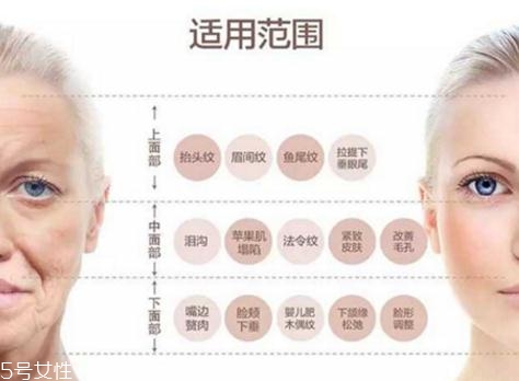 大v線會斷嗎？一定要選擇正規(guī)整形醫(yī)院