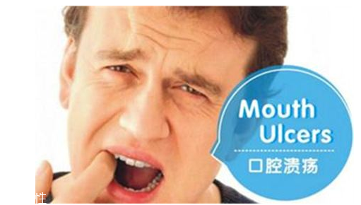 潰瘍的根源在哪里？也許僅僅只是牙膏沒選對