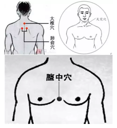 吮痧有什么療效？最溫柔的治病方法