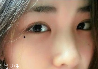 痣越多越長壽嗎？身上最有福氣的吉痣
