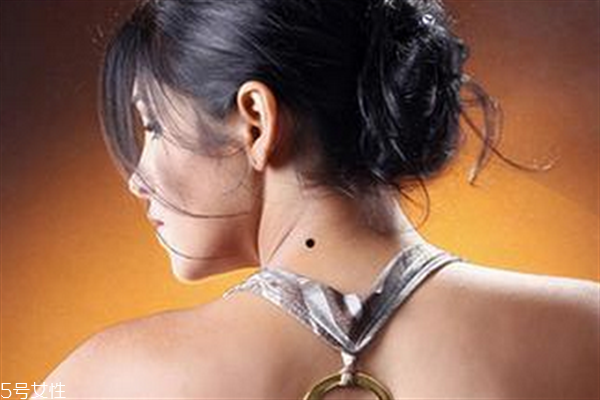 脖子后面有痣代表什么？10大身體缺陷是好事