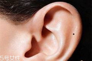 臉上哪些痣不能去掉？這些痣不能隨便祛掉