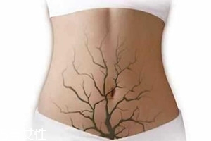 體內毒素超標有何表現(xiàn)？五大癥狀須注意