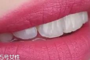 kiko哪個(gè)顏色適合黃皮？kiko口紅9系最便宜