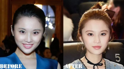 瑯琊榜2張慧雯整容了嗎？換了妝發(fā)美到不認識