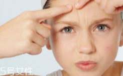 痘痘肌該怎么化妝？這樣化才利于肌膚恢復(fù)