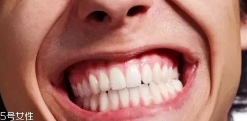 磨牙是因為受了委屈？孩子的心理狀況也會導(dǎo)致磨牙