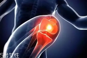 關(guān)節(jié)有響聲是病嗎？?jī)煞N情況區(qū)別對(duì)待