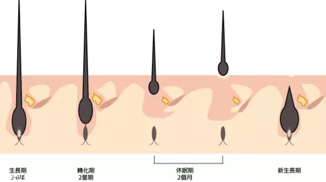 頭發(fā)為什么會(huì)掉？毛囊想休息了