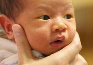 新生兒長黃疸怎么辦？有些黃疸癥狀媽媽們可別忽視