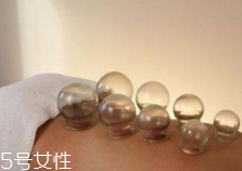 拔火罐引火上身的原因是什么？這4點要注意