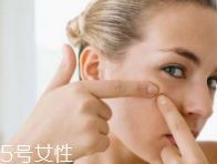 肌膚需要排毒嗎？長(zhǎng)痘并不代表排毒