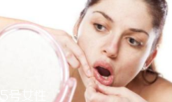 肌膚需要排毒嗎？長(zhǎng)痘并不代表排毒
