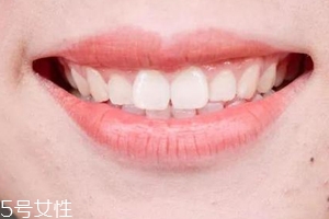 口紅病有哪些癥狀？使用不當(dāng)引發(fā)癌癥