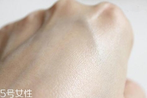 白癜風(fēng)與身體免疫功能有關(guān)系嗎？兩者關(guān)系密切