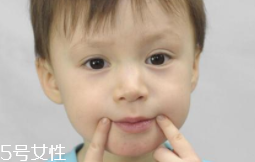 冬天爛嘴角什么原因？有可能營(yíng)養(yǎng)不良