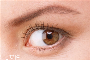 開眼角會影響視力嗎？開眼角會有危害