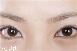 割雙眼皮后怎樣恢復(fù)快？女人不能割雙眼皮的時期