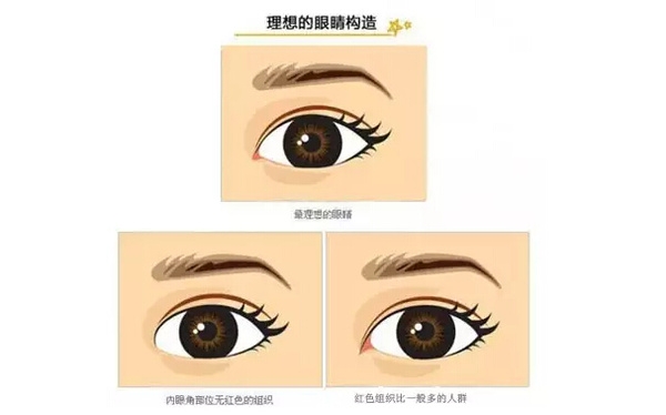 開外眼角和開內(nèi)眼角哪個好？開眼角有可能會回縮