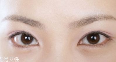 割雙眼皮的術(shù)前準(zhǔn)備有哪些？割雙眼皮的常見做法
