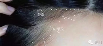 眉粉可以當(dāng)發(fā)際線粉嗎？解救高發(fā)際線的技巧