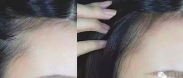 眉粉可以當(dāng)發(fā)際線粉嗎？解救高發(fā)際線的技巧