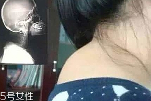 富貴包是什么??？姿態(tài)優(yōu)美少犯病