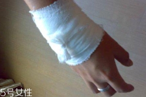被蜈蚣咬傷后能治愈嗎？科學(xué)家有新發(fā)現(xiàn)