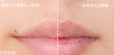 蘭芝唇膜吃進去怎么辦？擁有水嫩嘴唇