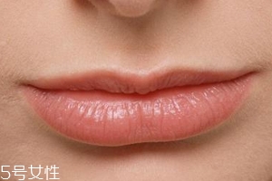 嘴唇干裂是一種病嗎？治療口角炎從改善習(xí)慣入手